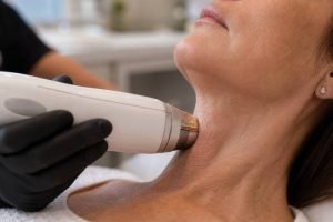 Plastic Surgery Blog Weston FL 5 kasv thermitight cost 1 1779754032933