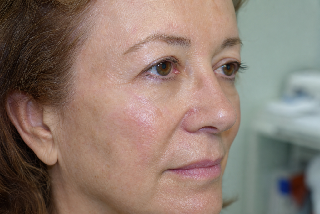 kasv facial mohs repair 1 1780550451274