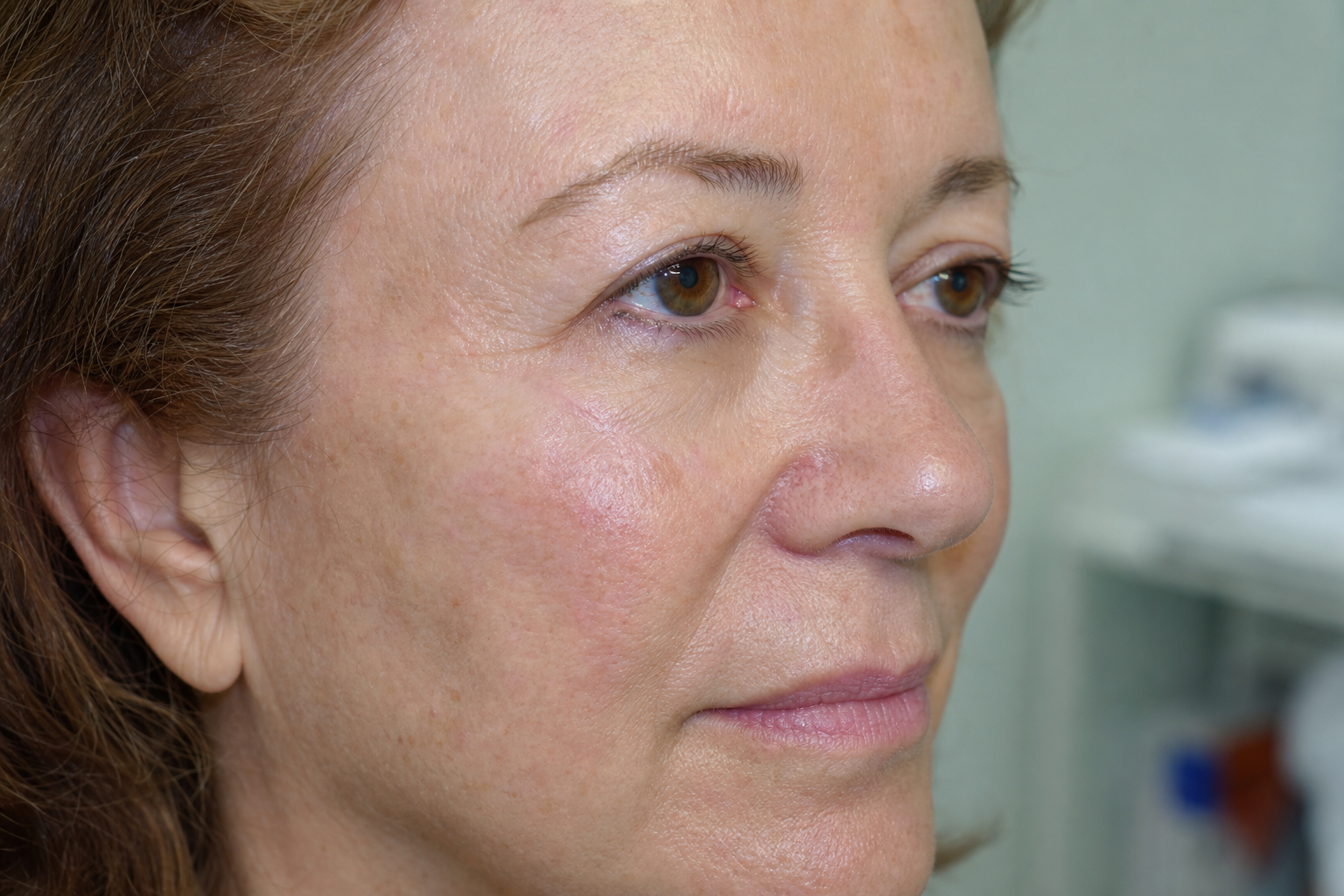 A professional, compassionate surgeon discussing facial skin reconstruction options with a patient, highlighting the delicate nature of Facial Mohs Repair.