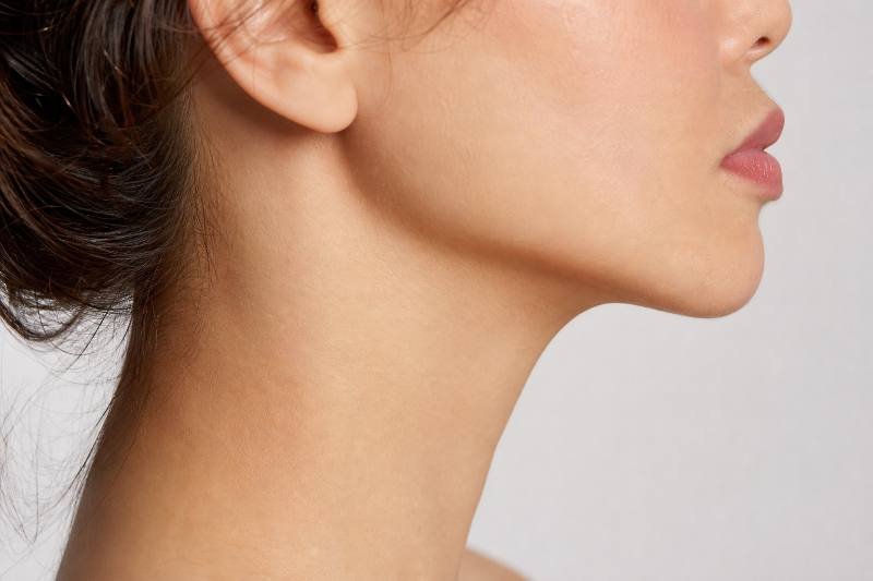 Neck Lift Expectations: 6 Amazing Secrets for a... 10 kasv neck lift expectations 1 1784577747522