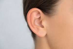 kasv otoplasty cost guide 1 1784662210275