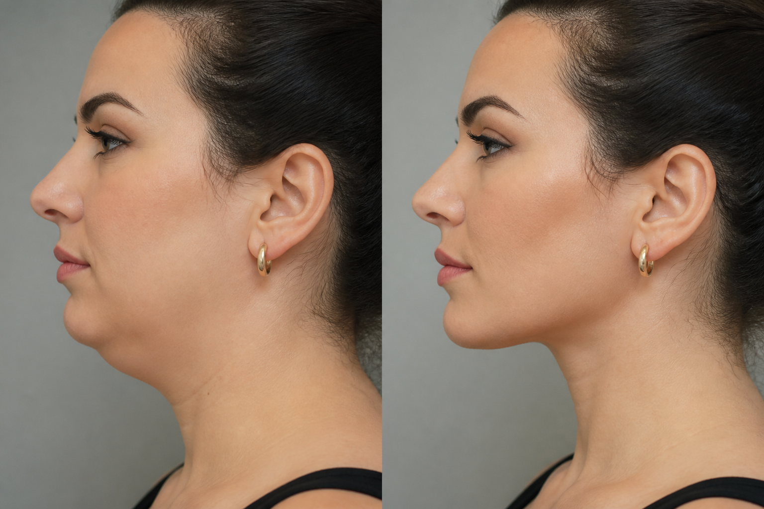 Jawline Definition Secrets: 5 Amazing Habits for Results 3 Jawline definition secrets
